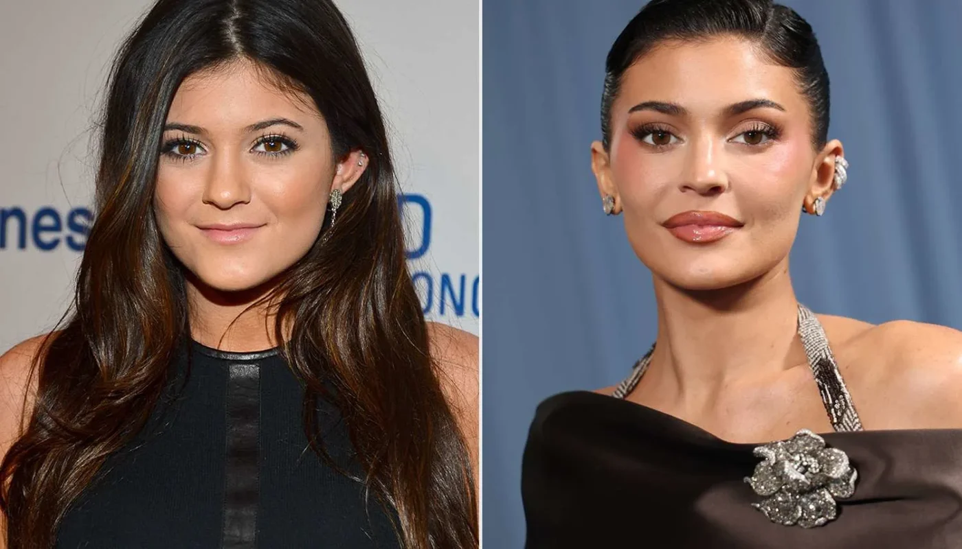 Kylie Jenner Plastic Surgery