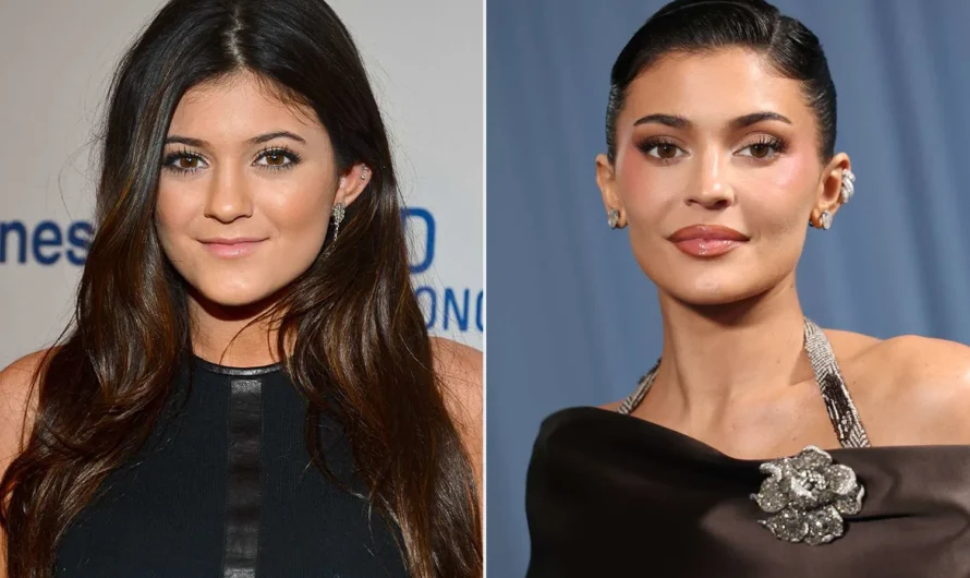 A Critical Look at Kylie Jenner’s Plastic Surgery, Fame, and Influence
